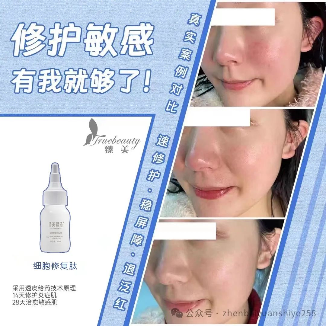 皮肤屏障修复乳_皮肤屏障修复产品推荐_怎么修复皮肤屏障